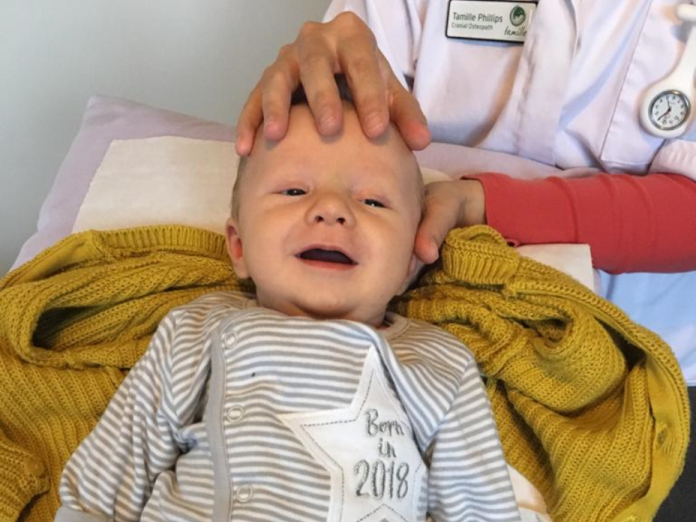 Image of sleeping baby receiving cranial treatment.